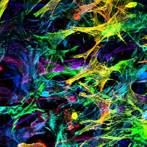 Depth-coded mammary cancer cells in collagen matrices under compressive force